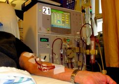 An arm is hooked up to a dialysis machine in a patient room